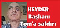 KEYDER Başkanı Tom’a saldırı